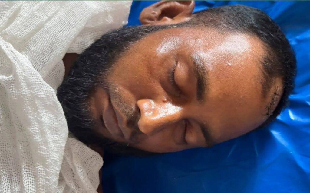 গ্লাসের আঘাতে প্রাণ গেল যুবকের, অভিযুক্ত গ্রেপ্তার